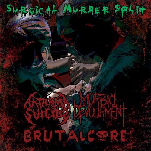 Surgical Murder
